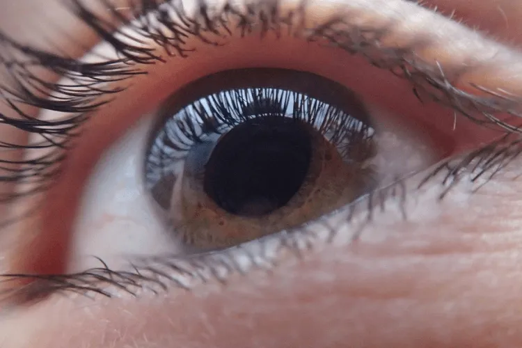 oko z zaćmą wt&oacute;rną i widok po kapsulotomii