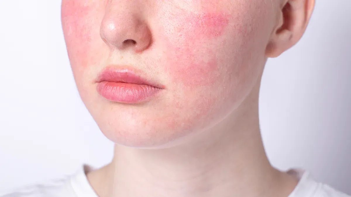 czynniki drażniące skórę wrażliwą