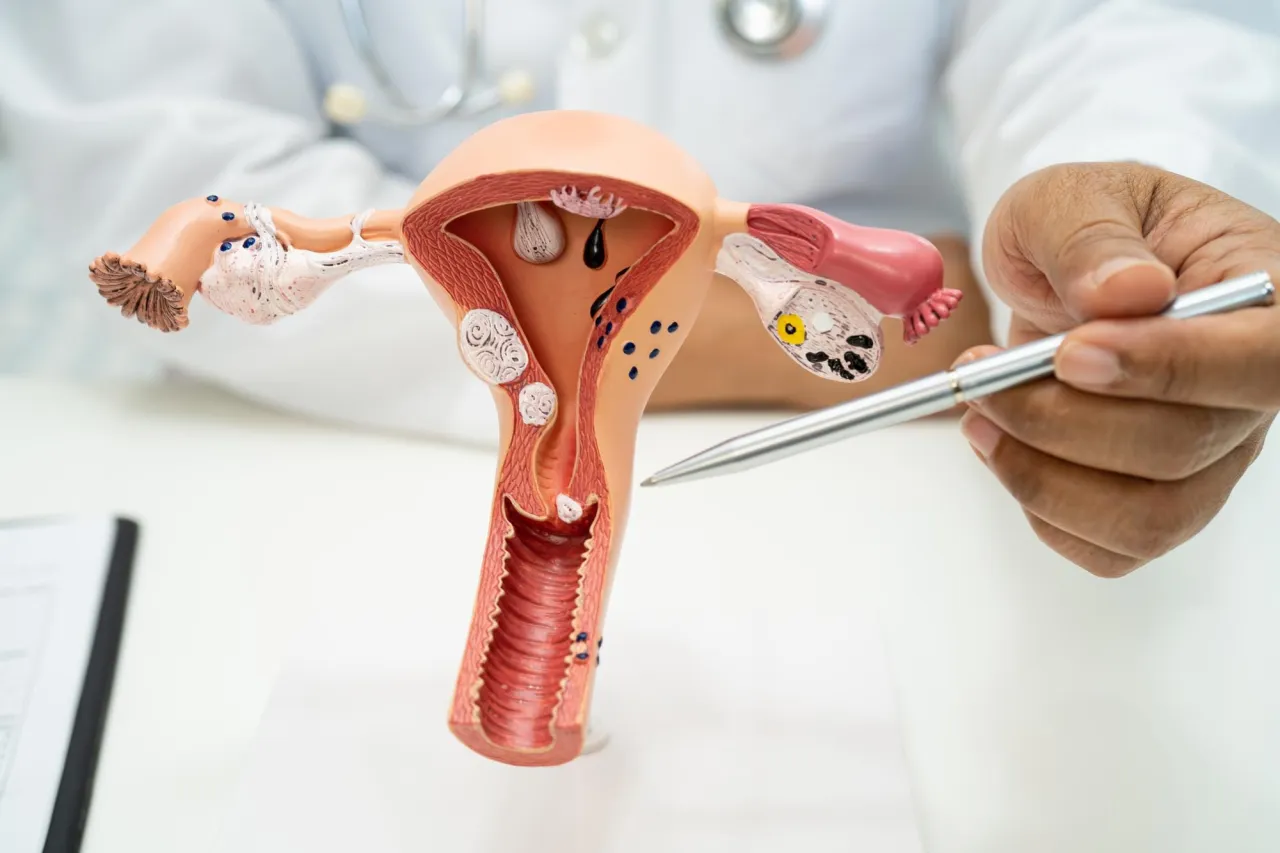 Leczenie skracającej się szyjki macicy pessar cerclage progesteron