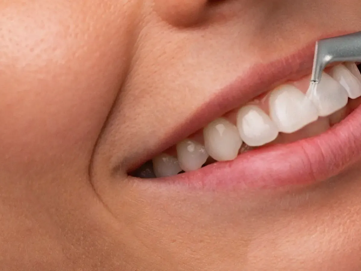 profesjonalna higienizacja zęb&oacute;w