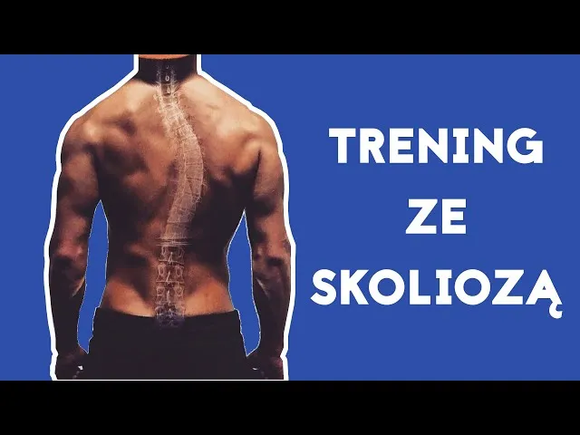 Ćwiczenia zakazane skolioza