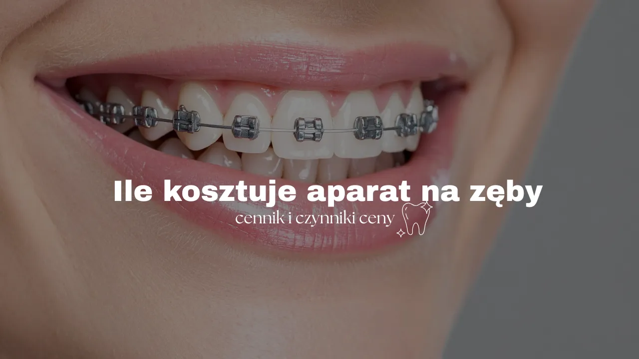 por&oacute;wnanie cen szyny relaksacyjnej i aparatu retencyjnego