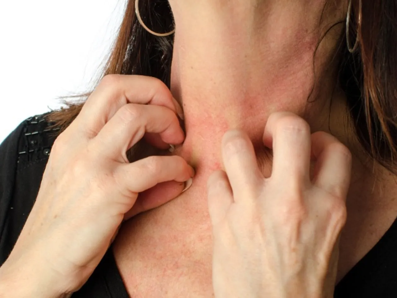 domowe sposoby na swędzenie sk&oacute;ry