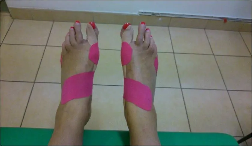 rodzaje taśm do tejpowania haluksa