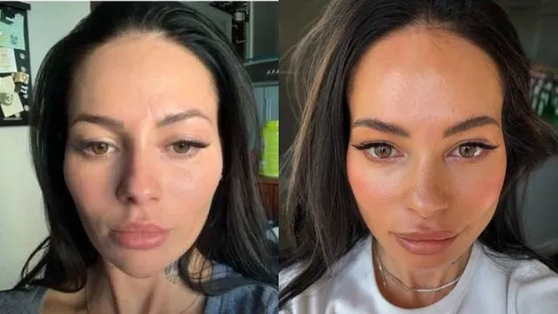 Kobieta po zabiegu botoksu, delikatnie dotykająca czoła, z tłem sali gimnastycznej w rozmyciu