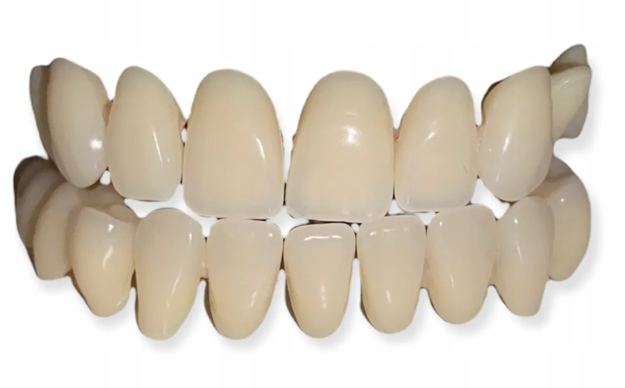 Zdjęcie Ile kosztują sztuczne zęby? Poznaj ceny i uniknij wysokich wydatków