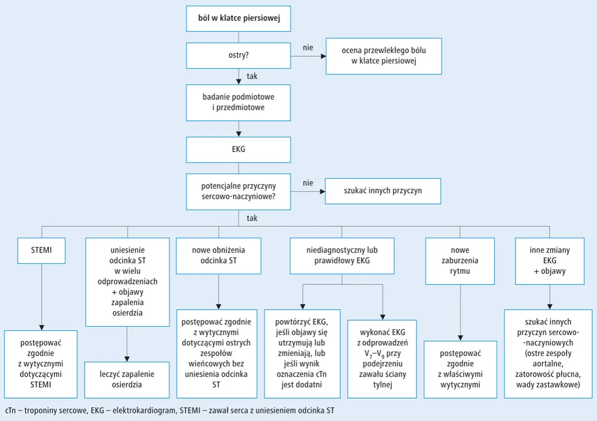 Ból dławicowy lokalizacja i promieniowanie
