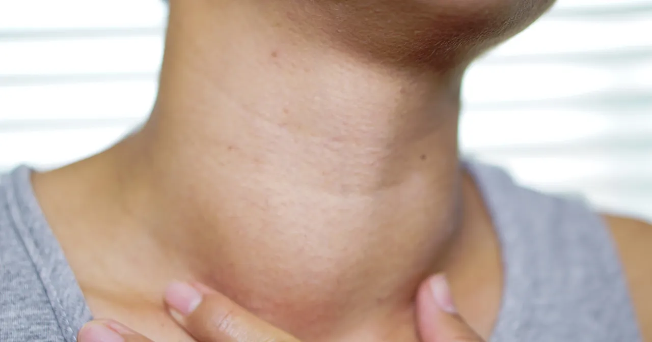 Wskazania do badania TRab, objawy choroby Gravesa-Basedowa