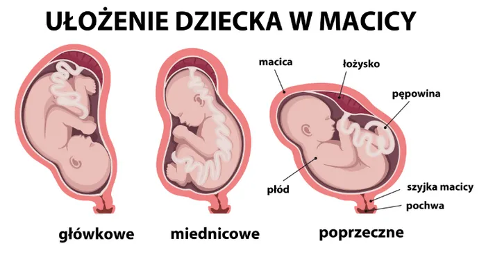 ułożenie płodu w macicy, położenie główkowe, położenie miednicowe, położenie poprzeczne