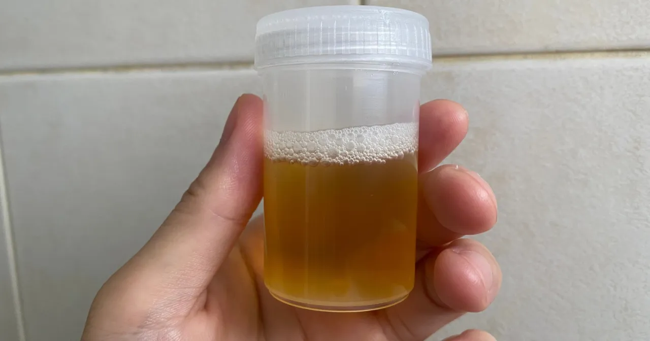 prawidłowe pobieranie moczu kobieta