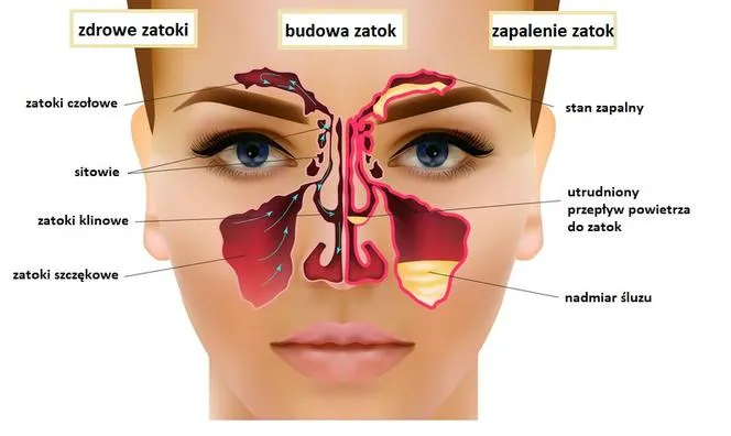 Zdjęcie Jakie badanie na zatoki? 5 skutecznych metod diagnostycznych