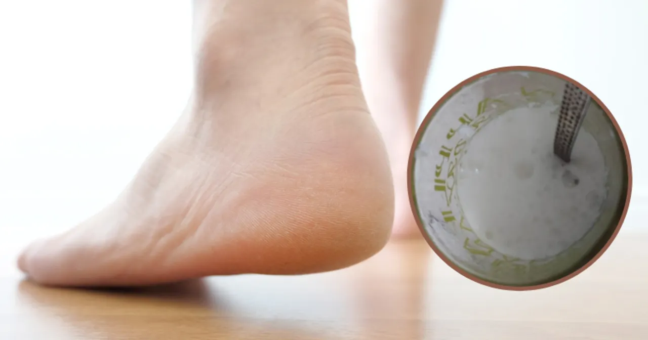 Zdjęcie Skuteczne metody na ból pięty - domowe sposoby i leczenie