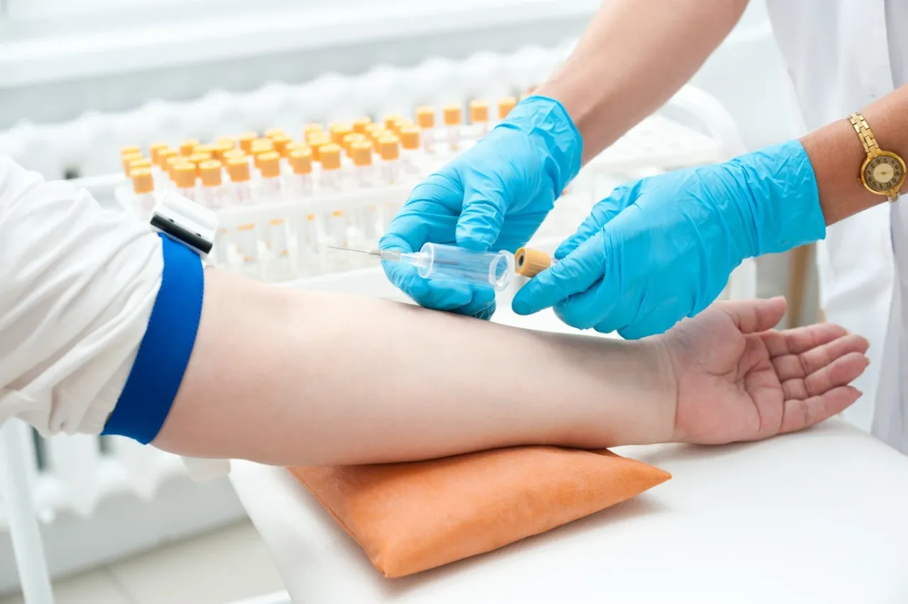 Kobieta trzymająca szklankę wody przed badaniem krwi, na tle laboratorium