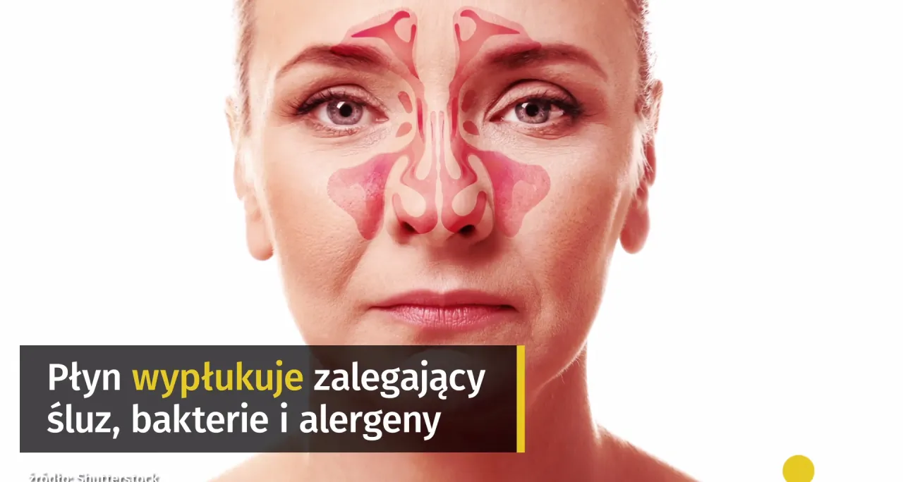 Objawy bólu zatok bez kataru mapa twarzy