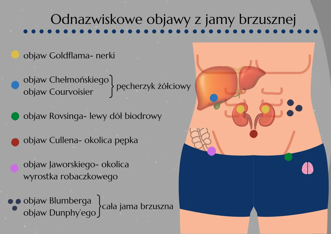 Zapalenie wyrostka robaczkowego objawy ból brzucha
