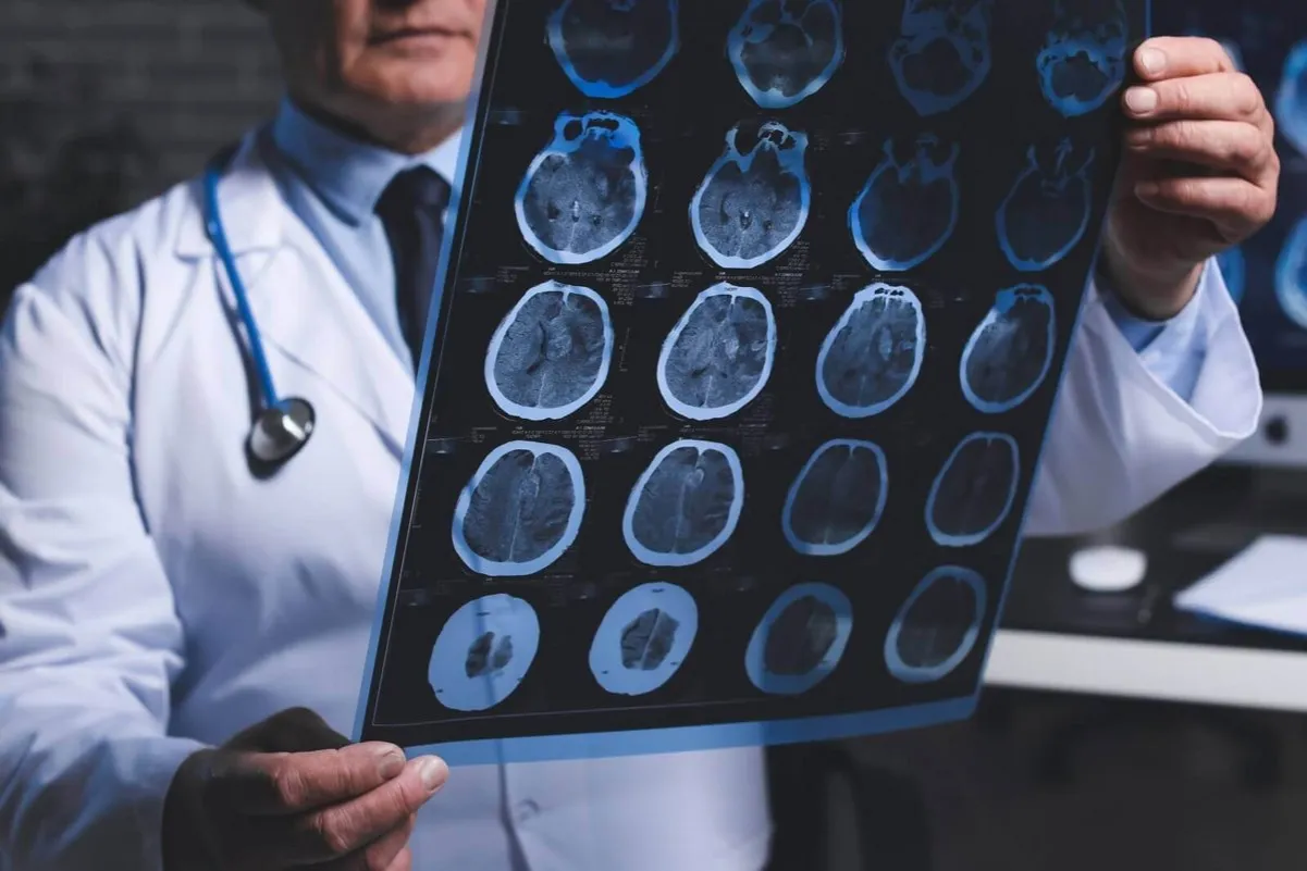 Lekarz neurolog bada pacjenta, układ nerwowy