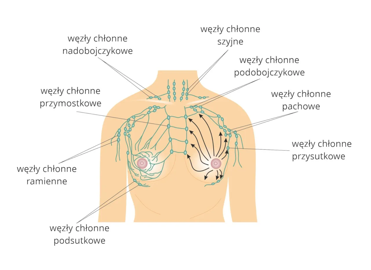 Drenaż limfatyczny manualny vs mechaniczny
