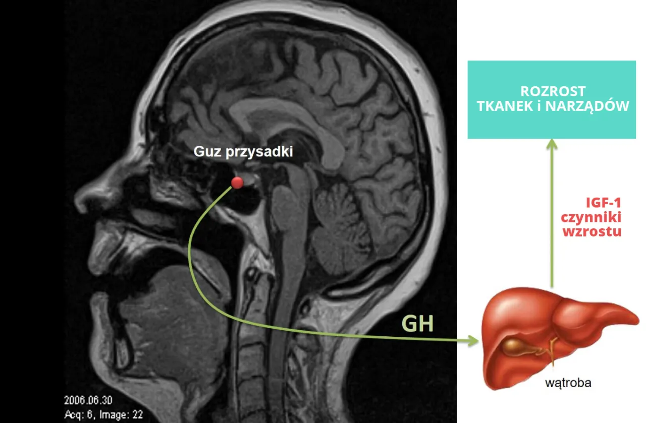 Analogi somatostatyny mechanizm działania