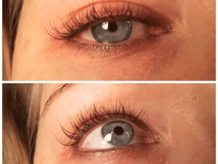 zdrowe rzęsy przed i po odżywce