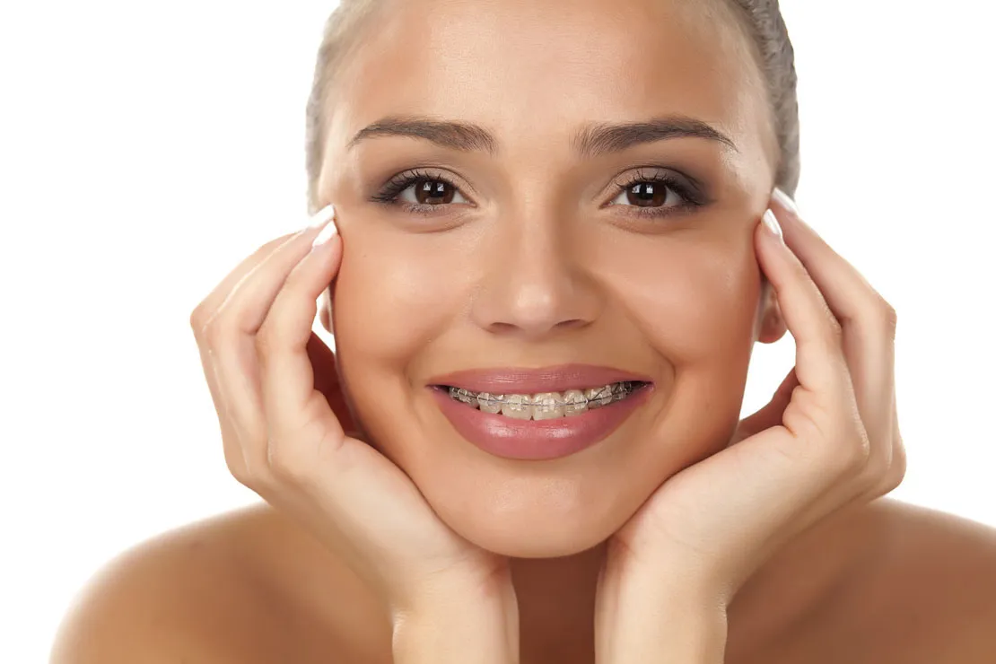 Zdjęcie Czy aparat na zęby powiększa usta? Odkryj prawdę o ich wyglądzie