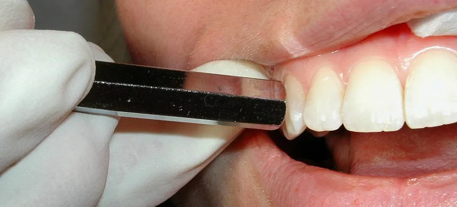 dentysta test opukiwania zęba