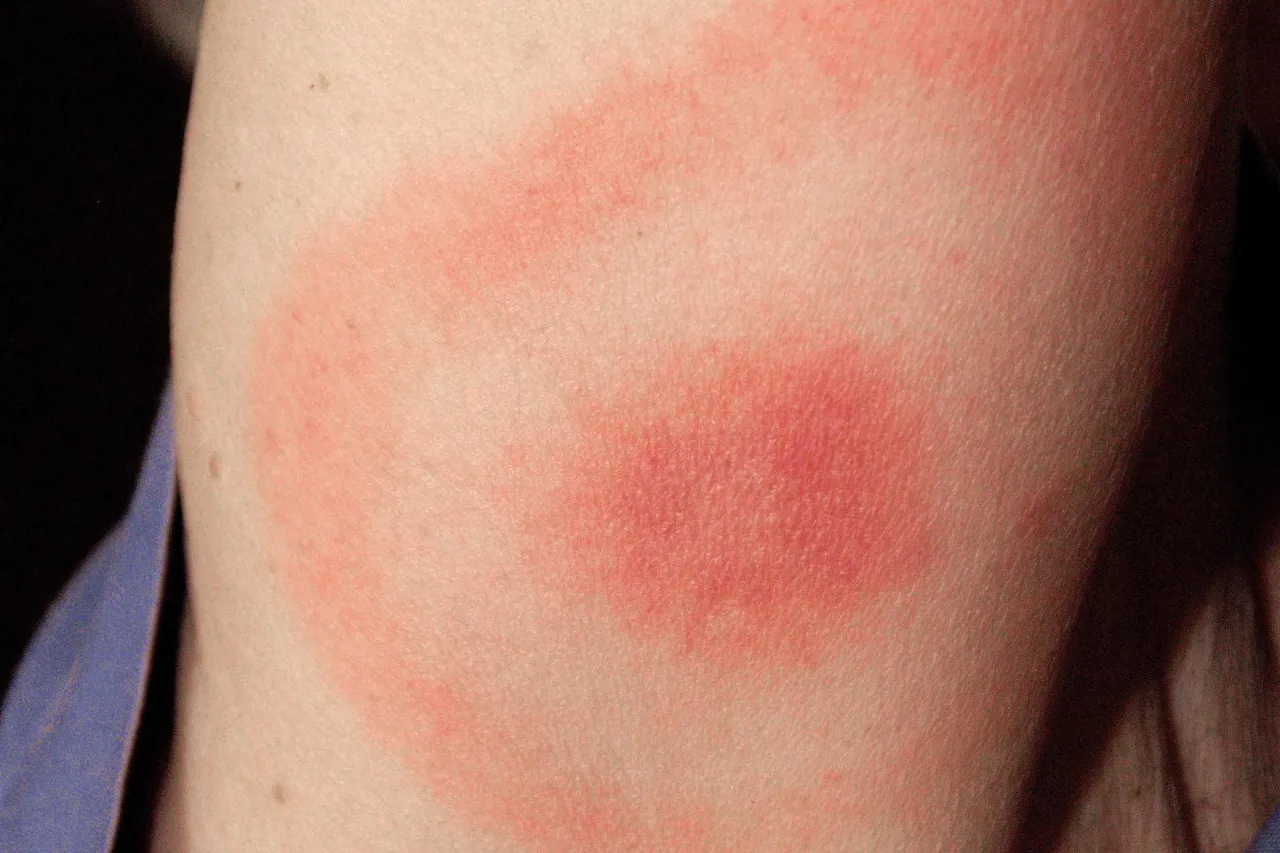 Mapa Polski z zaznaczonymi regionami o wysokim ryzyku boreliozy