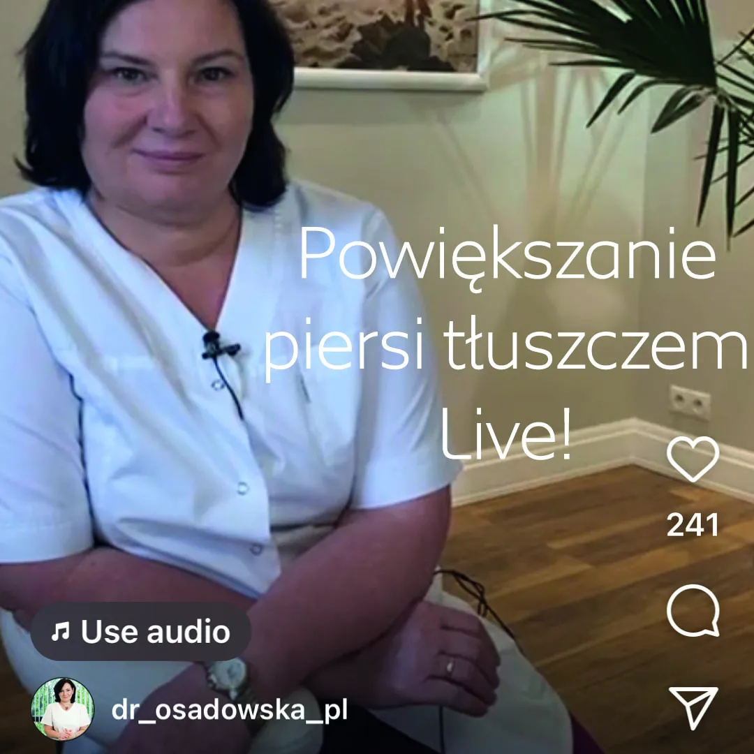 Zdjęcie Ile kosztuje powiększenie biustu własnym tłuszczem? Sprawdź ceny i czynniki wpływające na koszt