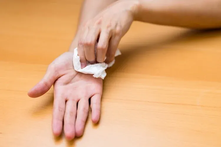 Zdjęcie Jak skutecznie zapobiec poceniu się dłoni i odzyskać komfort