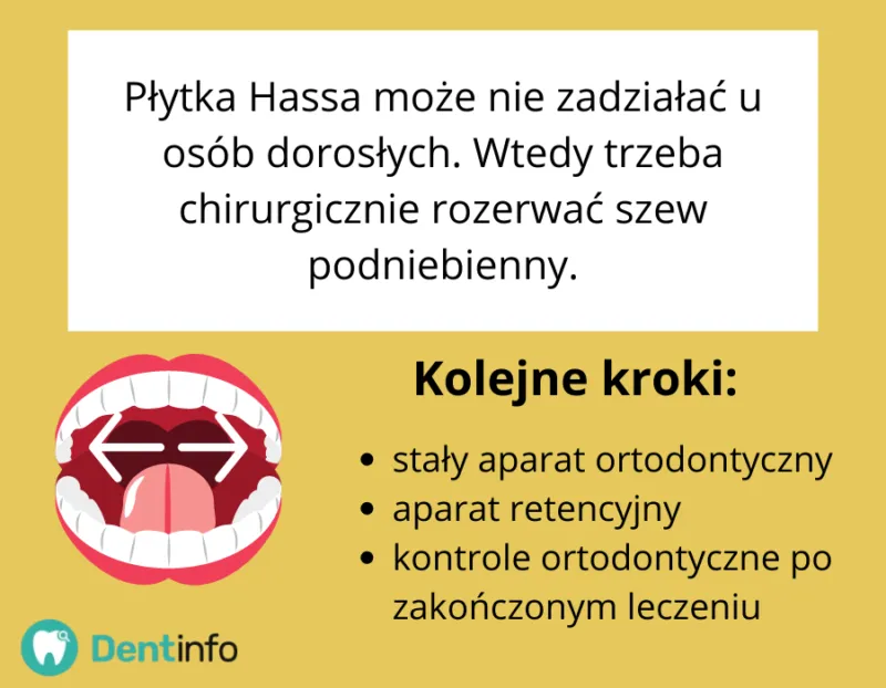 Zdjęcie Jak bezpiecznie przekręcać aparat Hassa bez ryzyka uszkodzenia i utraty gwarancji