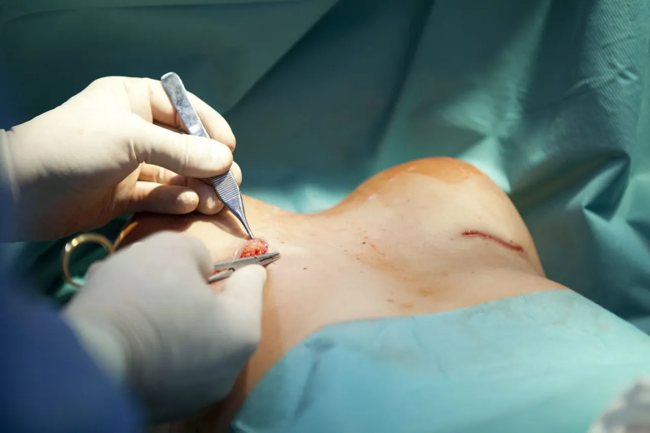 Zdjęcie Gdzie najlepiej zrobić operację powiększenia biustu? Ranking klinik