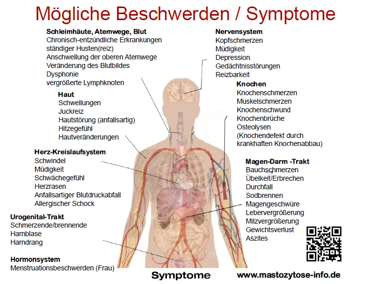Zdjęcie Mastozytose Diagnostik: Wichtige Kriterien und Methoden zur Erkennung