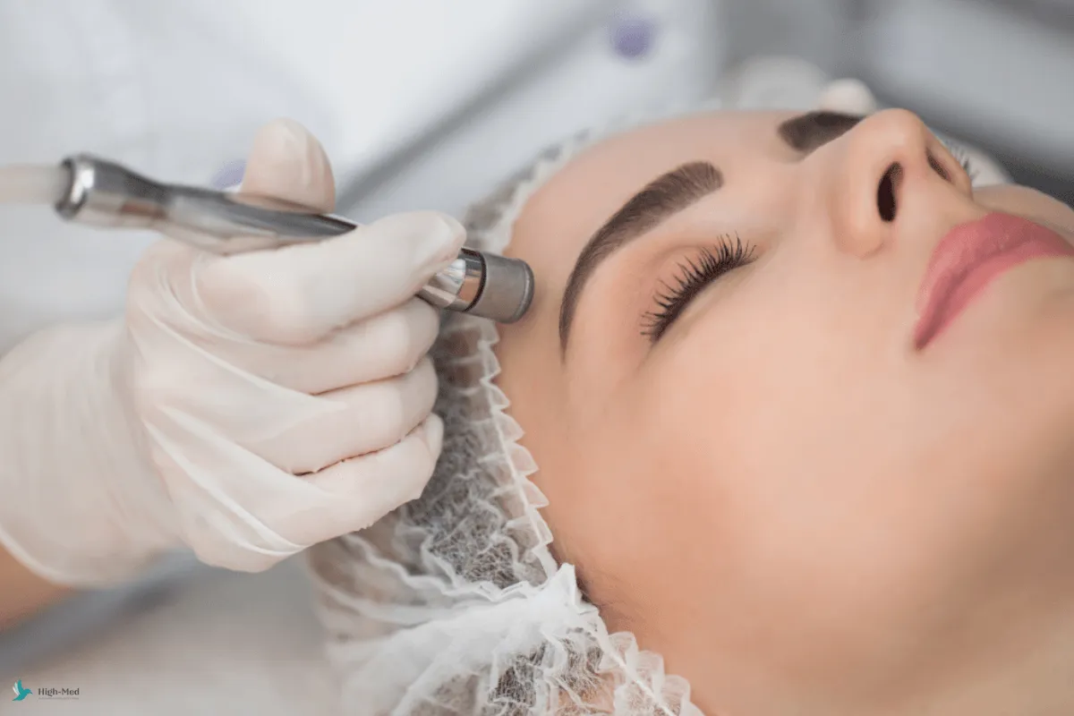 Zdjęcie Peeling kawitacyjny czy mikrodermabrazja – która metoda lepiej odmłodzi twoją skórę?