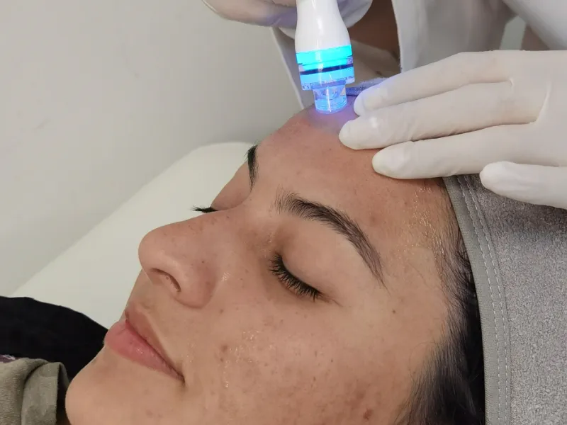 Zdjęcie Aqua Pure limpieza facial: transforma tu piel y elimina impurezas