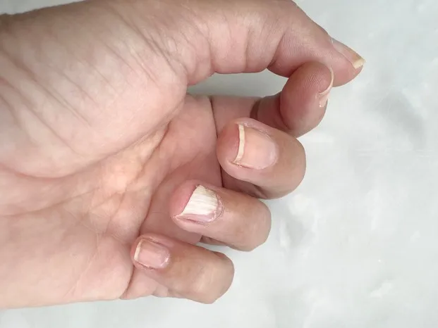 Zdjęcie Czy paznokieć odrasta? Jak dbać o łożysko i przyspieszyć wzrost