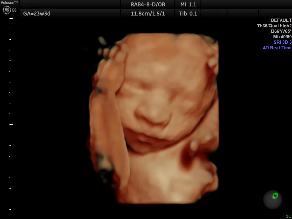 Zdjęcie Jak wygląda badanie prenatalne w II trymestrze? Kluczowe informacje i cele