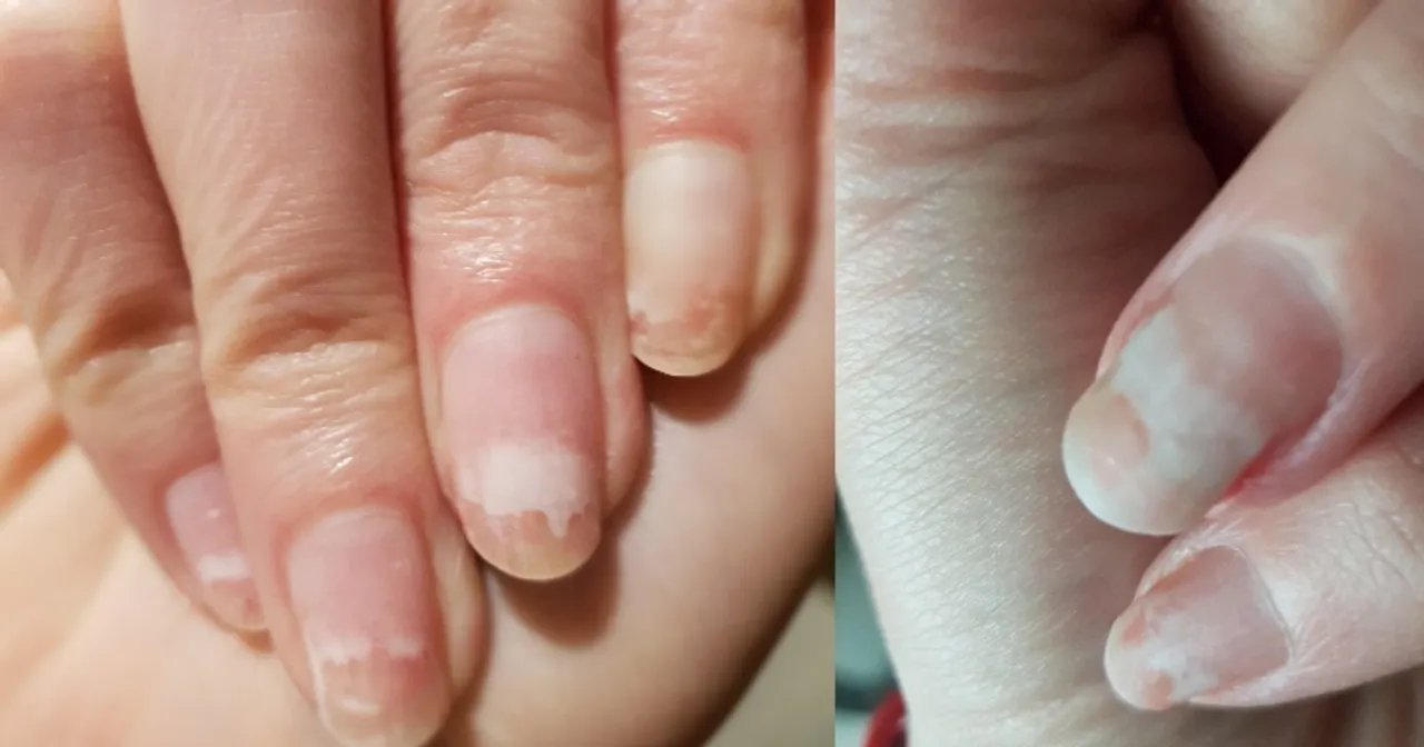 Zdjęcie Dlaczego hybryda matowieje po cleanerze? Poznaj przyczyny i rozwiązania