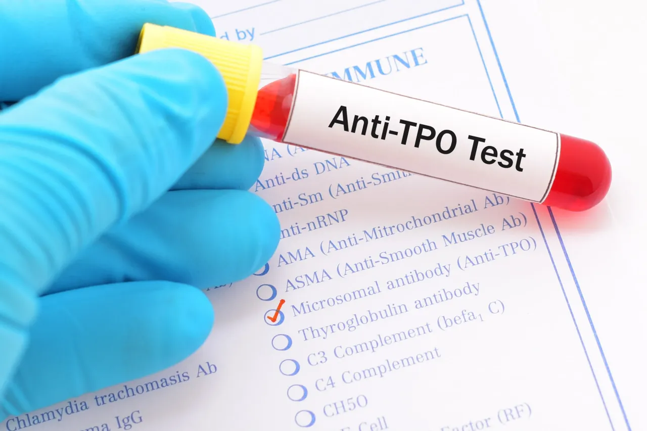 Zdjęcie Anty TPO - kluczowe badanie w diagnostyce chorób tarczycy