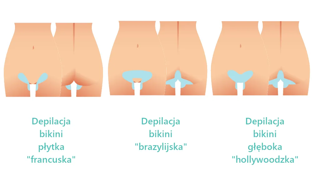 Zdjęcie Jak golić miejsce intymne damskie bez podrażnień – skuteczne metody i porady