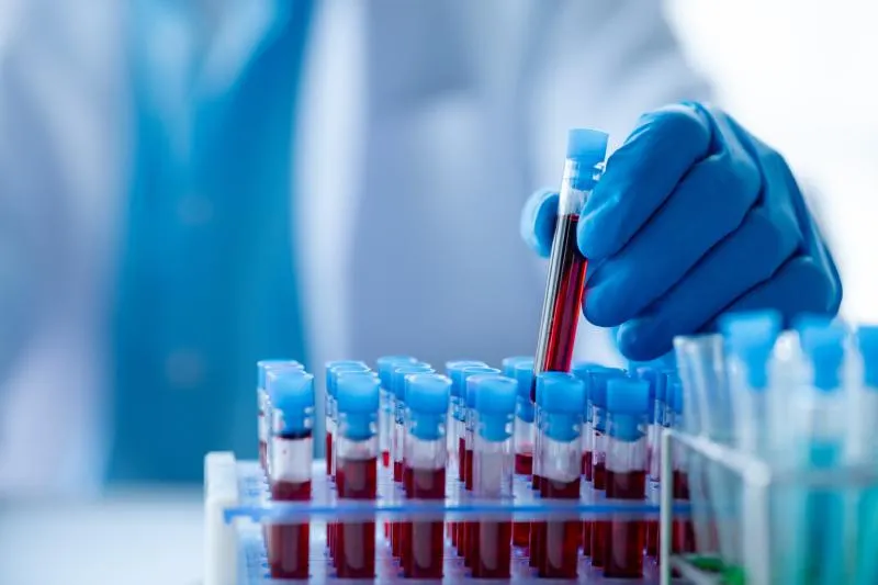 Zdjęcie Co to jest PCT w badaniu krwi? Kluczowe informacje o prokalcytoninie