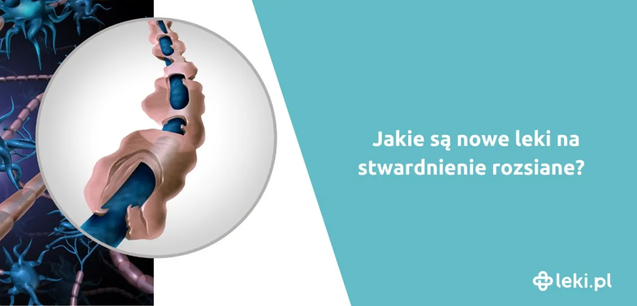 Zdjęcie Czy leki na stwardnienie rozsiane są refundowane? Sprawdź szczegóły refundacji
