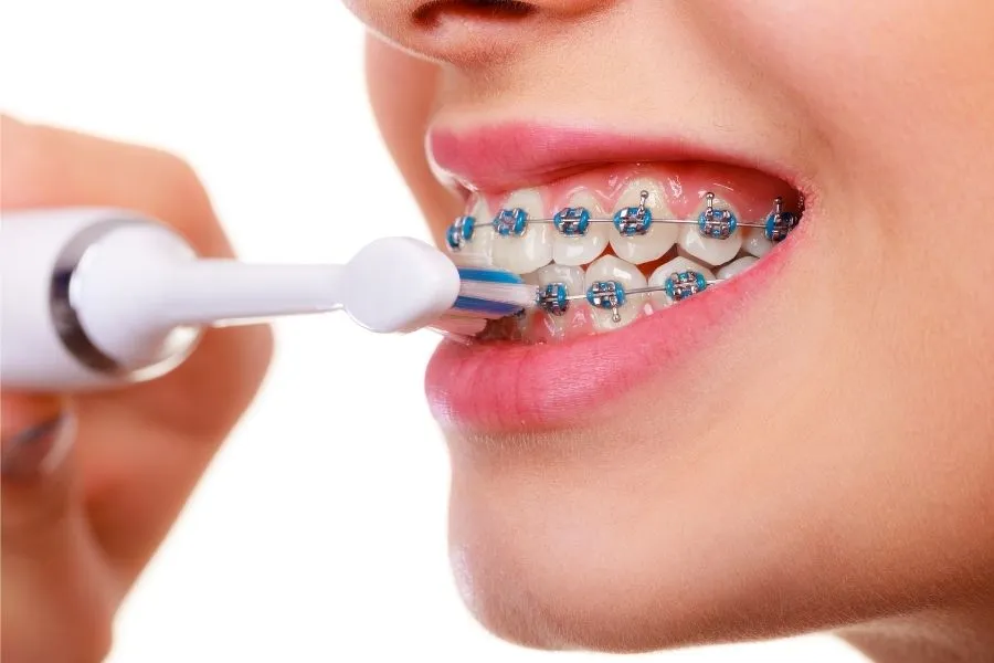 Zdjęcie Jak często myć zęby szczoteczką soniczną, aby uniknąć problemów?