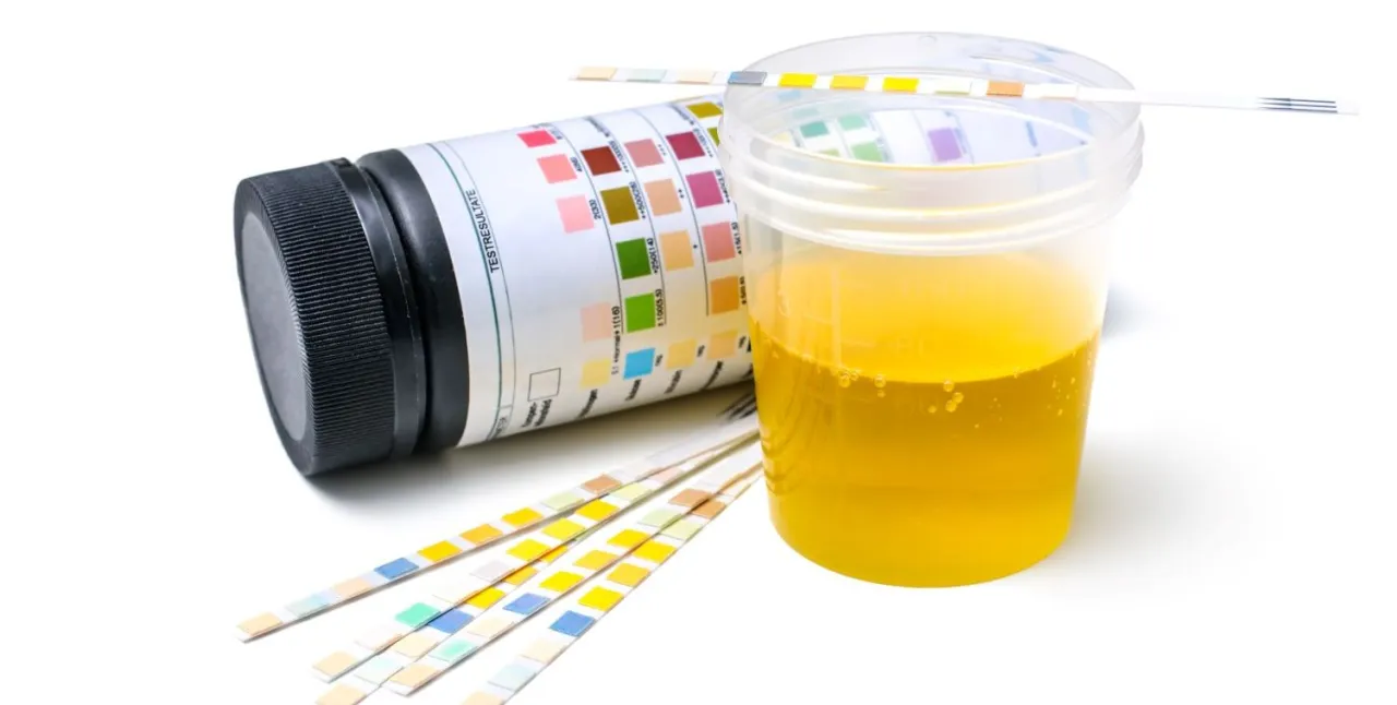 Zdjęcie Gdzie trzymać mocz przed badaniem, aby uniknąć błędów w wynikach?