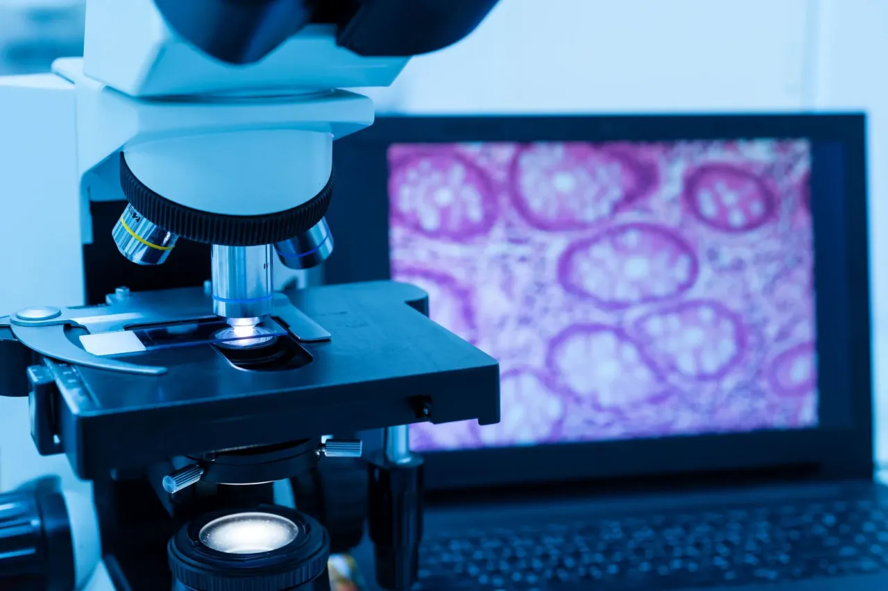 Zdjęcie Czym jest badanie histopatologiczne? Klucz do diagnozy nowotworów