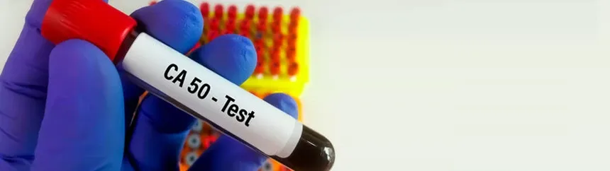 Zdjęcie Kluczowe markery jelitowe w diagnostyce – dogłębny przegląd.