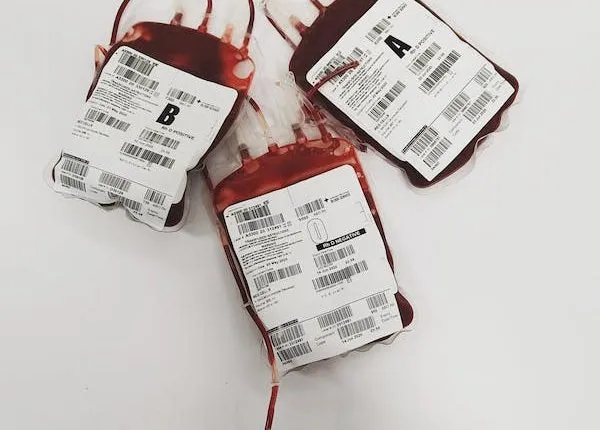 Zdjęcie Co to jest 1 jednostka krwi i ile wynosi? Oto kluczowe fakty