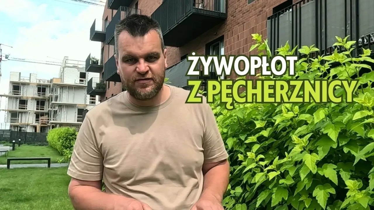 Zdjęcie Jak sadzić pęcherznicę w żywopłocie, aby uniknąć błędów w odległości?