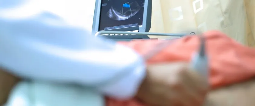 Zdjęcie Jak długo trwa badanie echo serca? Czas trwania, który musisz znać