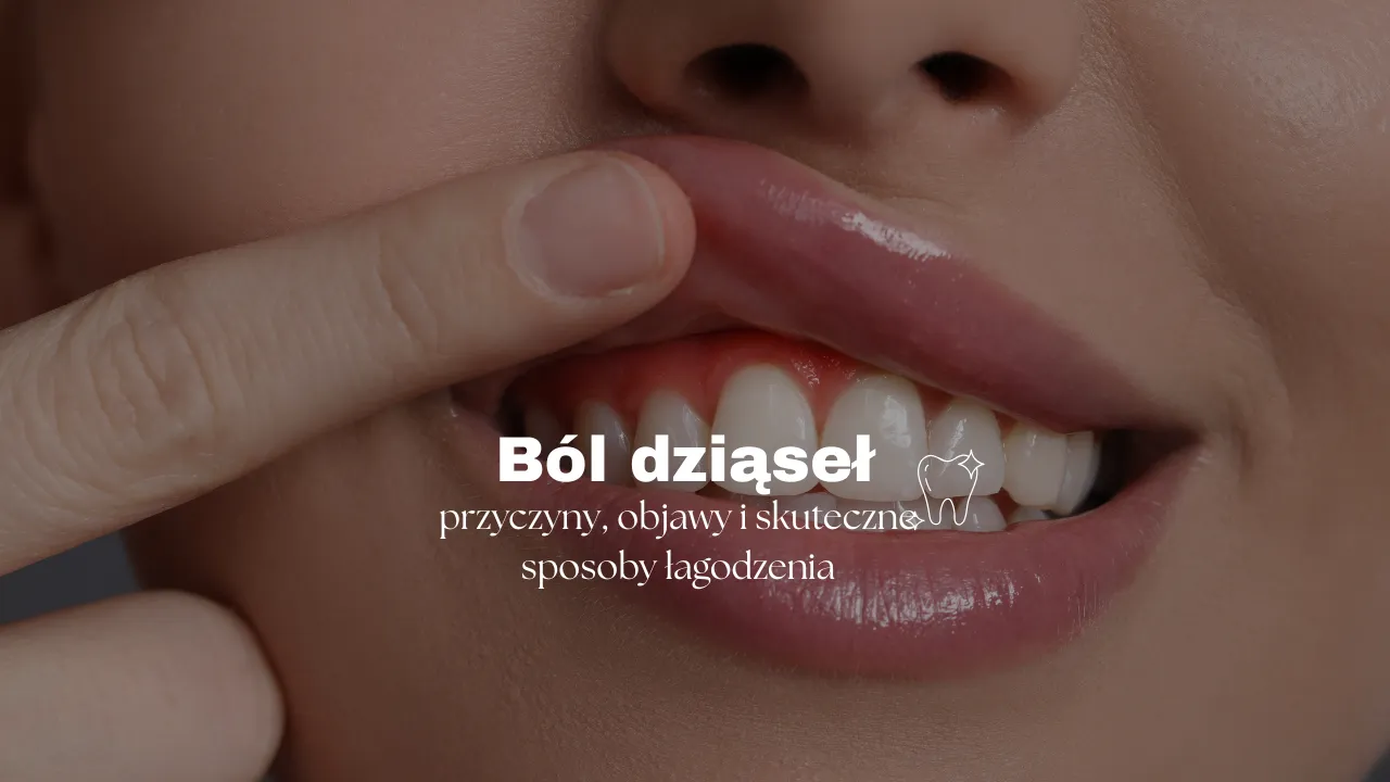 Zdjęcie Ból dziąseł? Sprawdzone sposoby na ulgę i kiedy iść do dentysty