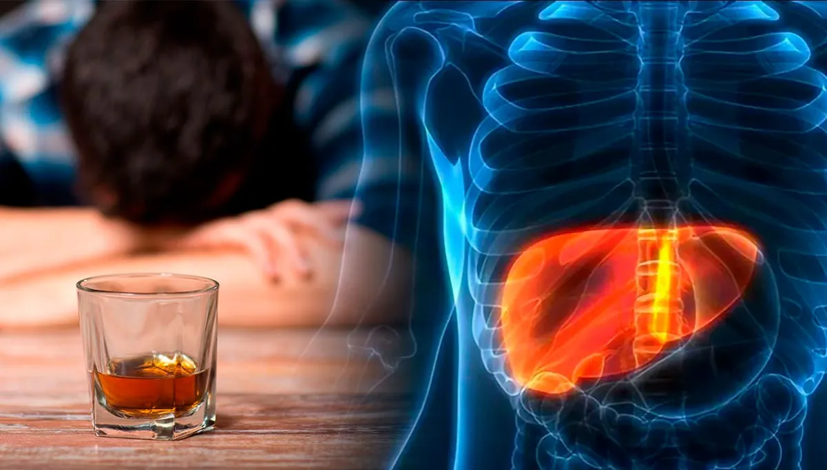 Zdjęcie Medicamentos para el hígado alcohólico: ¿realmente protegen tu salud?