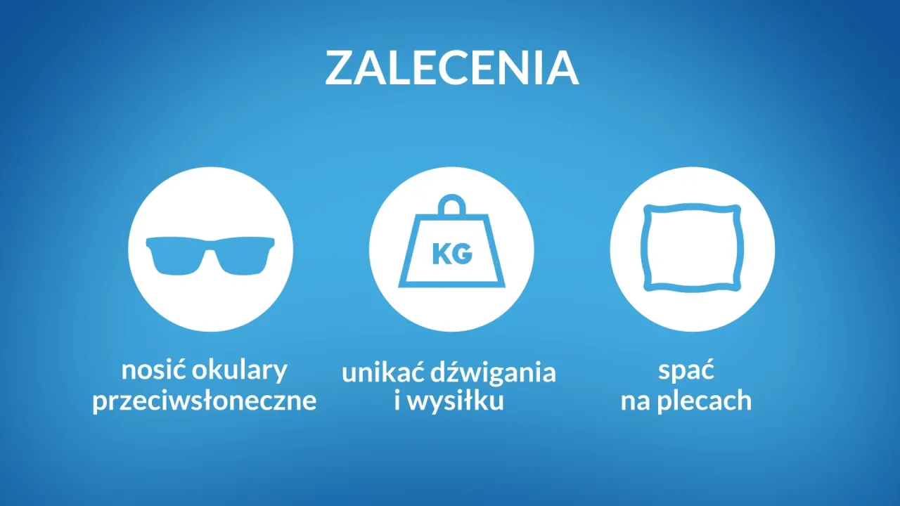 Zdjęcie Zalecenia po operacji zaćmy: uniknij najczęstszych błędów w pielęgnacji